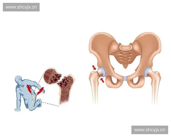 以髋部发力为核心的全身动力链协同训练新理念解析与运动表现提升路径研究